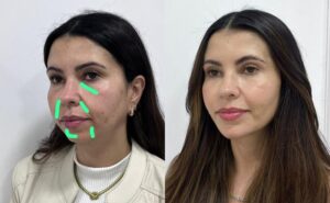 As sombras do rosto denunciam a idade