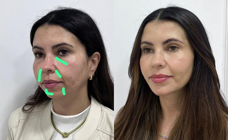 As sombras do rosto denunciam a idade