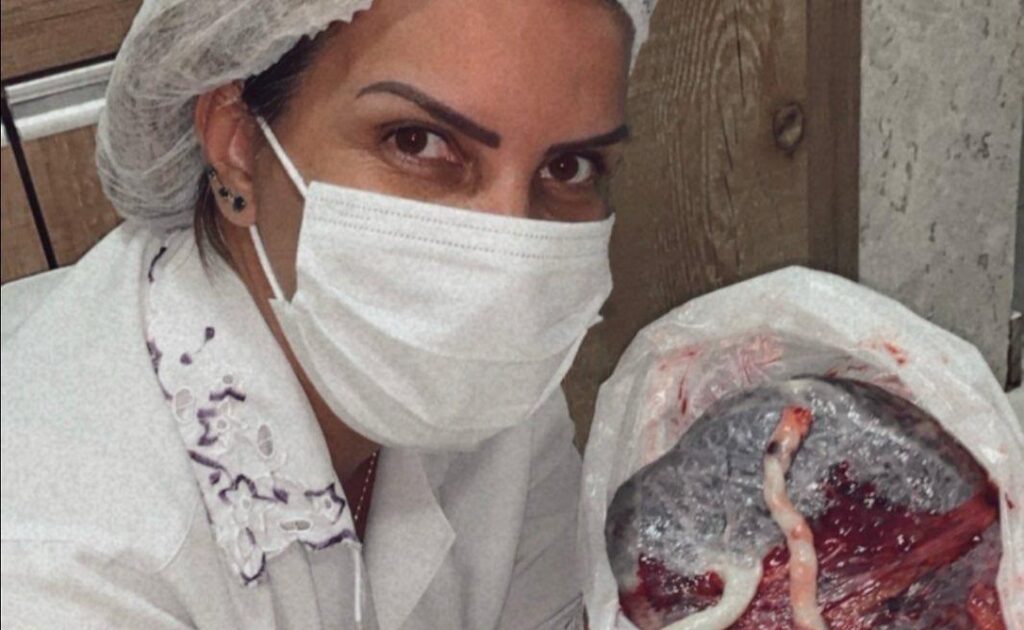 Terapia Bioplacentária: a pesquisa e o protocolo exclusivo da Dra. Silvana Correia ganha destaque internacional