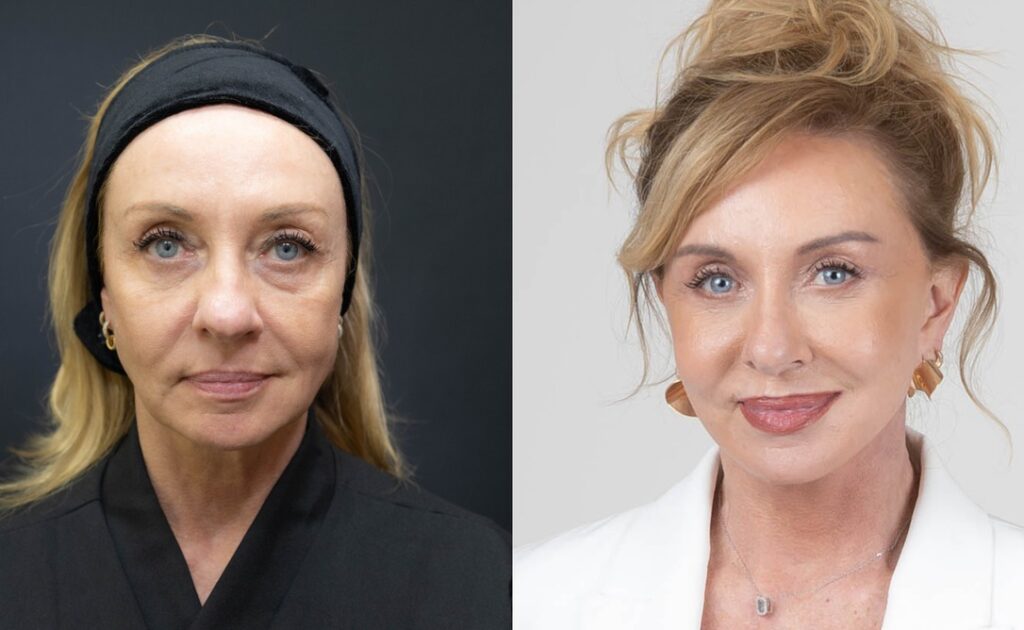 “Bem-vindos ao luxo”: corretora de imóveis de alto padrão investe em facelift para fortalecer imagem profissional